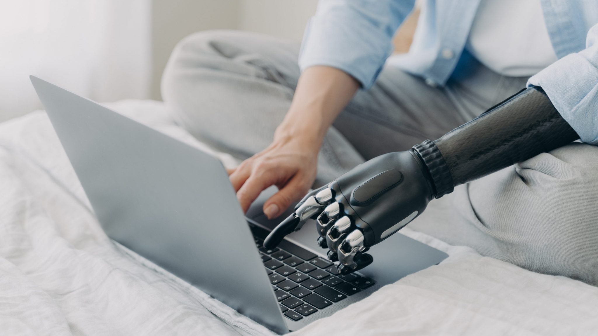 Pessoa sentada na cama com as pernas cruzadas toca o teclado de um notebook à frente com suas duas mãos, sendo uma delas uma prótese mecânica.